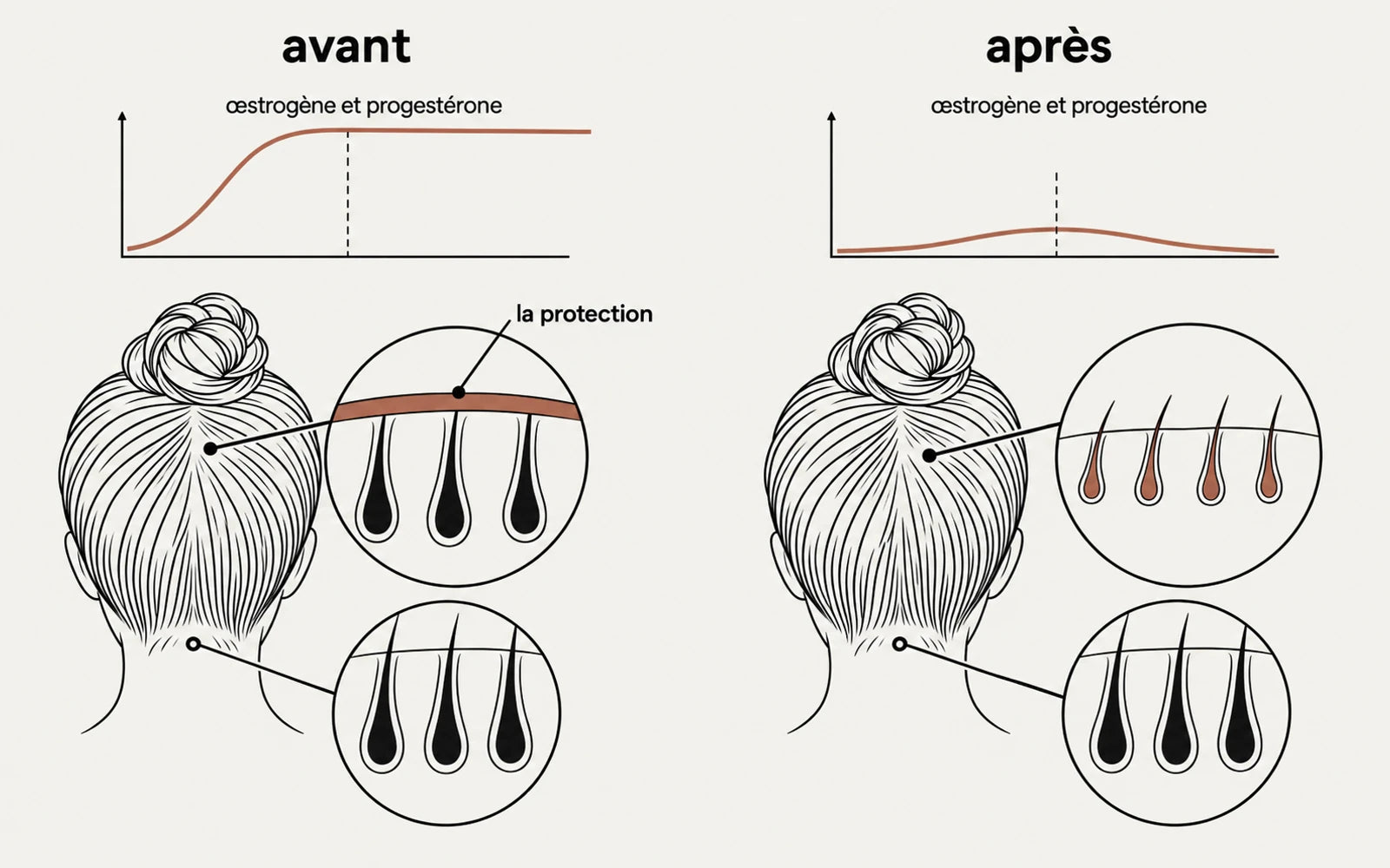 La ménopause ne retire pas les cheveux. Elle retire la protection.